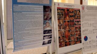 Maghrebin Congress of clinical anatomy University Bejaia 16 17 Juin 2019 75