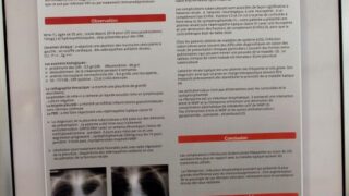 2eme journee nationale de Nephrologie de Bejaia Universite Bejaia 18 Oct 2019 058